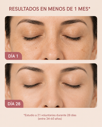 GlowLabs Éclat — Máscara Facial LED